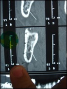 dentascanner-mesure